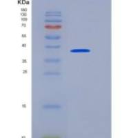 小鼠Dickkopf相关蛋白3(DKK3)重组蛋白His tag