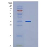 小鼠DR6重组蛋白His Tag