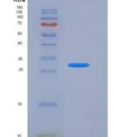 小鼠TIM4 / TIMD4重组蛋白His tag