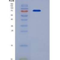 小鼠VEGFR2 / Flk-1 / CD309 / KDR重组蛋白His tag