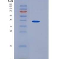 人CD90 / THY-1重组蛋白Fc Tag
