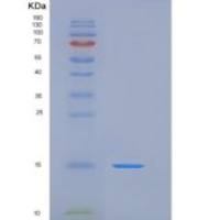 人PLA2G2A / PLA2B重组蛋白His tag