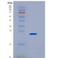 人ULBP1 / N2DL1重组蛋白His tag