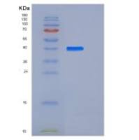 小鼠FGFRL1 / FGFR5重组蛋白His tag