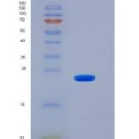 人CD48重组蛋白His Tag