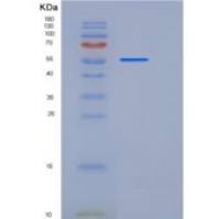 小鼠基底细胞粘附分子(BCAM)重组蛋白His tag
