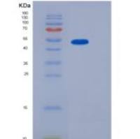 人α1-B-糖蛋白(a1BG)重组蛋白His Tag