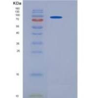 人VE-Cadherin / CD144 / CDH5重组蛋白His & Fc tag