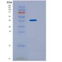 人Hemojuvelin / HFE2重组蛋白His tag