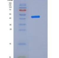 人诺戈受体(Nogo Receptor)重组蛋白His Tag