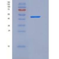 小鼠Angiotensinogen / SerpinA8 / AGT重组蛋白His tag