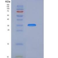 大鼠B7-H6 / B7H6 / NCR3LG1重组蛋白His Tag