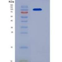 人LRAP / ERAP2重组蛋白His tag