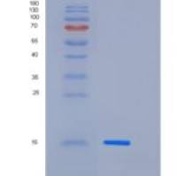 小鼠Cystatin C / CST3重组蛋白His tag