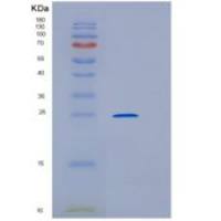 小鼠内皮细胞粘附分子(ESAM)重组蛋白His tag