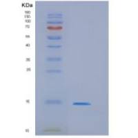 小鼠白细胞关联免疫球蛋白样受体1(LAIR1)重组蛋白His tag