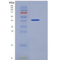 小鼠REN1 / Renin-1重组蛋白His tag