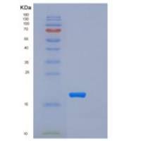 小鼠髓细胞触发受体2(TREM2)重组蛋白His tag