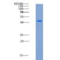 小鼠VSIG4重组蛋白His & Fc tag