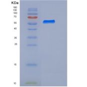 人Biotinidase / Biotinase / BTD重组蛋白His tag