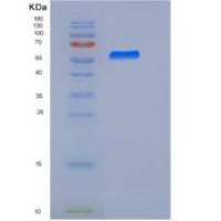 人Biotinidase / Biotinase / BTD重组蛋白His tag