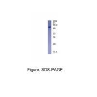 重组人RTCB蛋白(N-His标签)