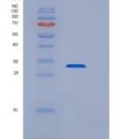 小鼠CTSZ / CTSX / Cathepsin Z重组蛋白His tag