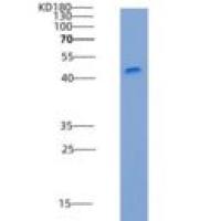 小鼠柯萨奇病毒腺病毒受体(CXADR)重组蛋白His & Fc tag
