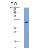 小鼠CD5抗原样蛋白(CD5L)重组蛋白His Tag