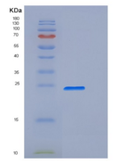 小鼠CD32 / FCGR2B重组蛋白His & AVI t