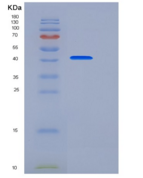 小鼠Cystatin 7 / CST7重组蛋白Fc tag