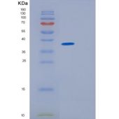 大鼠CD5分子(CD5)重组蛋白His tag