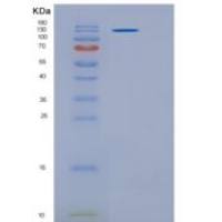 人PAPPA2 / Pappalysin 2重组蛋白His tag