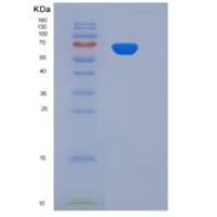 人SMPD1 / ASM重组蛋白His tag