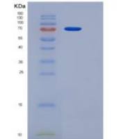 小鼠多聚免疫球蛋白受体(PIGR)重组蛋白His tag