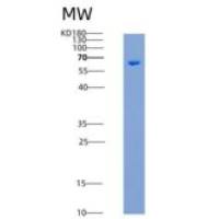 人丁酰胆碱酯酶重组蛋白His Tag
