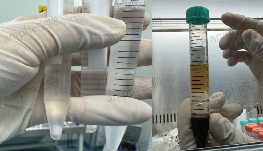 疾病模型|免疫治疗中的huPBMC人源化小鼠模型