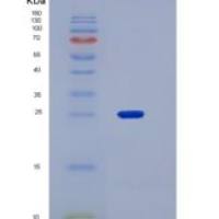 人TrkA / NTRK1重组蛋白aa 194-413, His tag