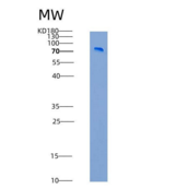 人SLITRK1重组蛋白His & Fc tag
