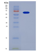 人成纤维细胞生长因子受体4(FGFR4)重组蛋白Fc tag