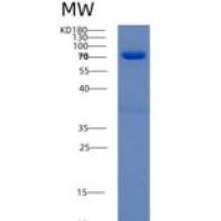 人SPARC相关组件钙结合蛋白1(SMOC1)重组蛋白