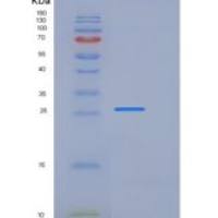 人白介素20受体α(IL20Ra)重组蛋白His tag