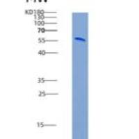 大鼠Thrombomodulin / THBD重组蛋白His tag