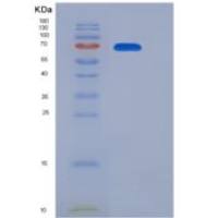 小鼠白介素12受体β2(IL12Rb2)重组蛋白His tag