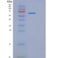 人PTPN2 / TC-PTP重组蛋白aa 1-314, His & GST tag