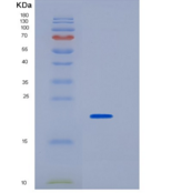 小鼠CD32 / FCGR2B重组蛋白His tag
