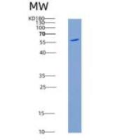 小鼠CD62L / L-Selectin / SELL重组蛋白His & Fc tag)