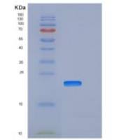 小鼠CLEC7A / Dectin-1 / CLECSF12重组蛋白His tag