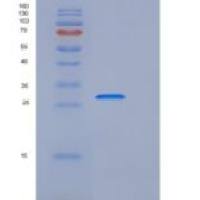 小鼠CD226分子(CD226)重组蛋白His Tag