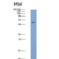 小鼠芳基硫酸酯酶A(ARSA)重组蛋白His tag